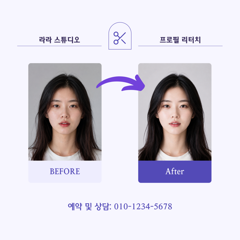 비포·애프터 시술 비교 카드 (사진 2장형)