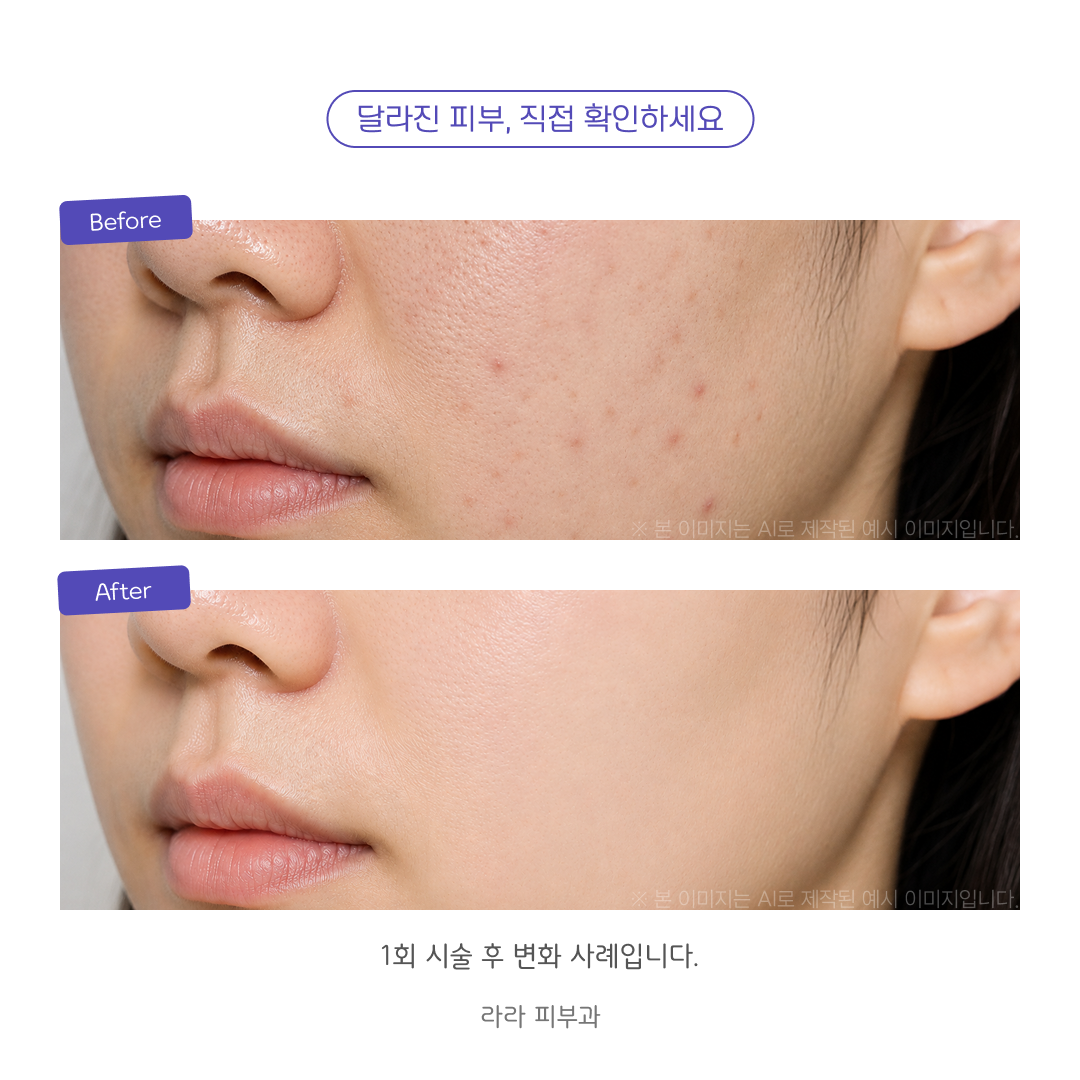 신뢰가는 전후 비교 카드 (사진 2장 위아래형)