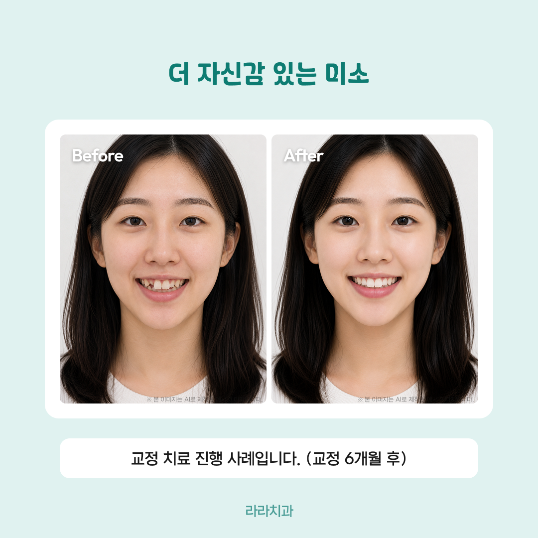 임팩트 전후 비교 카드 (사진 2장 좌우형)